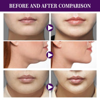 Luthasolic V-Line Lifting Band Facial Lift Patch