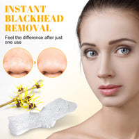 Tioueo Nose Strips 80 Packs, Blackhead Remover Pore Strips, Blackhead Pore Strip, Deep Cleansing Nose Strips for Clearer Skin White