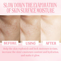 2pcs Watermelon Face Cream, Watermelon Skin Care, Watermelon Essence Face Cream, Lighten Acne Spots, Moisturising & Whitening Face Cream, 2pcs*50ml