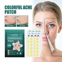 LIDOUK 12mm and 8mm spot patches, acne patches, star shaped, water-based gel patches for acne, blemishes, cyanosis, and facial acne patches (112 patches)