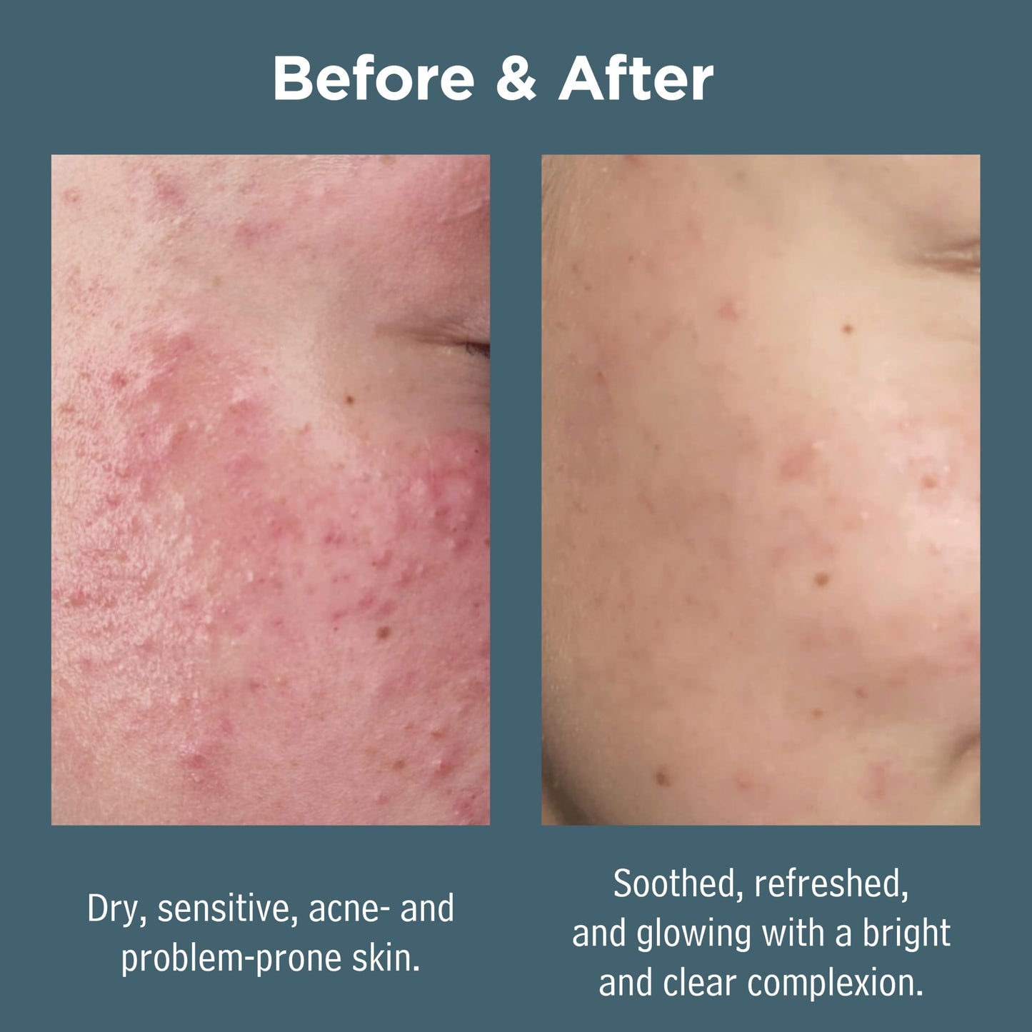 Sea Magik - Face Exfoliator Scrub, Suitable for All Skin Types (75ml)