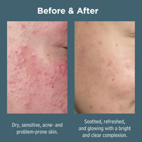 Sea Magik - Face Exfoliator Scrub, Suitable for All Skin Types (75ml)