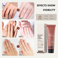 HERBINSOLS Retinol Hand Cream - Anti Aging Hand Cream - Hand Repair Cream Firming & Moisturising - Retinol Moisture Intensive hand cream for Very Dry Hands, Care for Skin, Nails & Cuticles