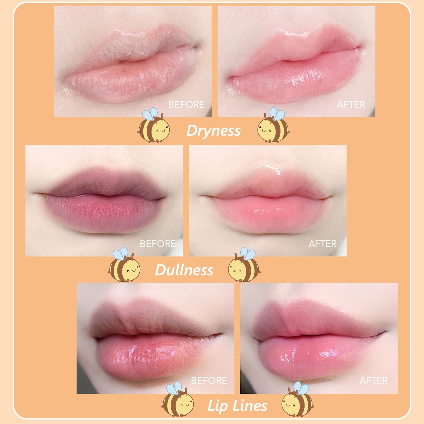 HERBENJOY Lip Balm Set, Moisturizing Lip Balm Multipack Fruity Flavoured Chapstick, Honey Bottel Shape Hydrating Lip Mask - Peach, Blueberry, Strawberry, Avocado Lip Balms For Moisturize Anti-Cracking