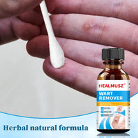 Enigmapn Wart-Remover Painless Skin and Fast-Acting, Wart-Remover for Hands and Body Fall Away Quickly, Natural Remover-15ml
