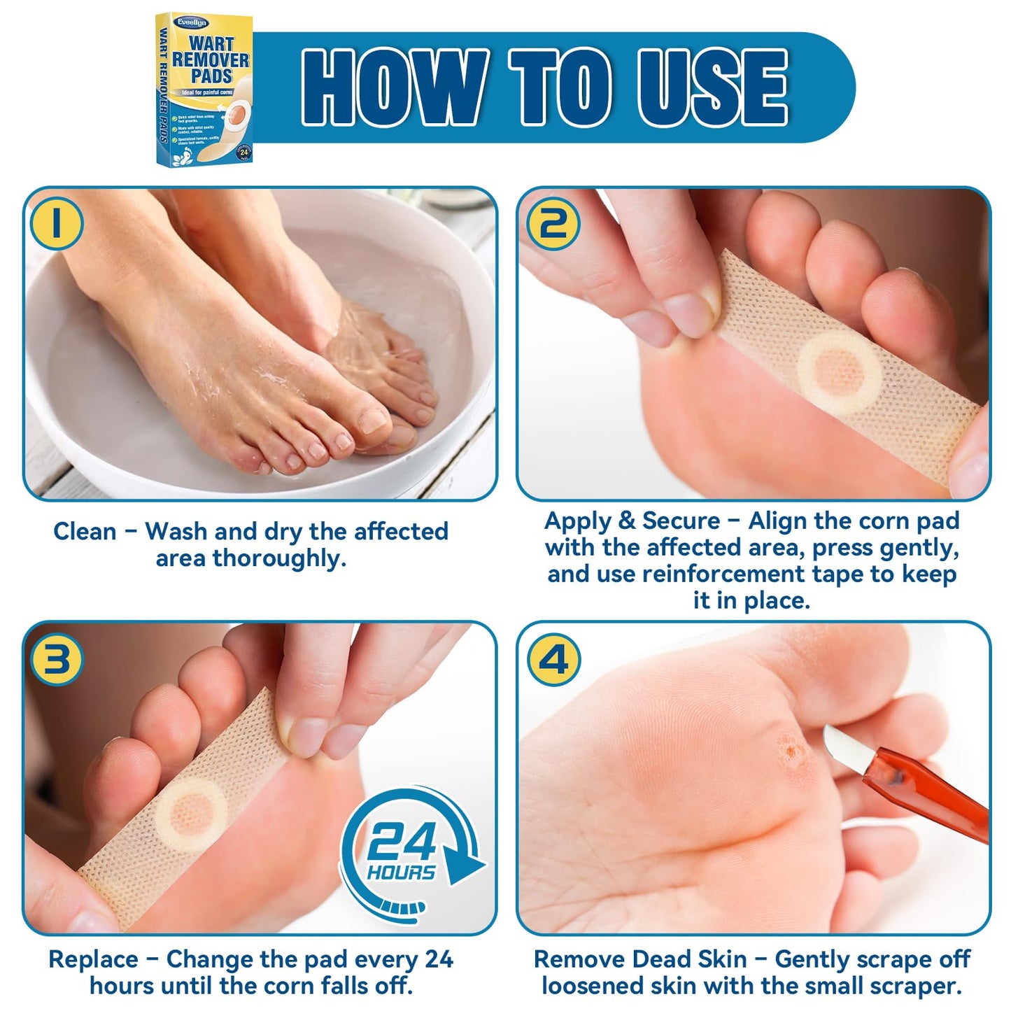 Eveellyn Wart Removal