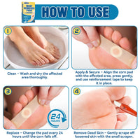 Eveellyn Wart Removal