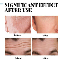 GNAUMORE Skin Tightening Mens Crea,Anti-aging Cream for Men,Facial Cream Moisturiser for Men,Collagen Mens Anti-Wrinkle Creame,Menn Face Creama Reduce Fine Lines and Wrinkles,Skin Creame Forr Menn