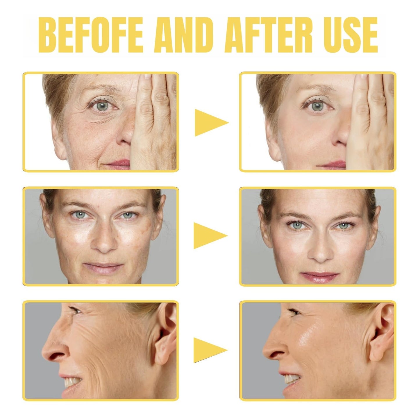 Frankincense Resin Oil for Face,Frankincense Essential Oil,Cold Pressed Serum Anti-Aging & Wrinkle,Frankincense Oil for Skin Organic,Facial Oil,Natural Frankincense Oil for Skin Care,Serum Face