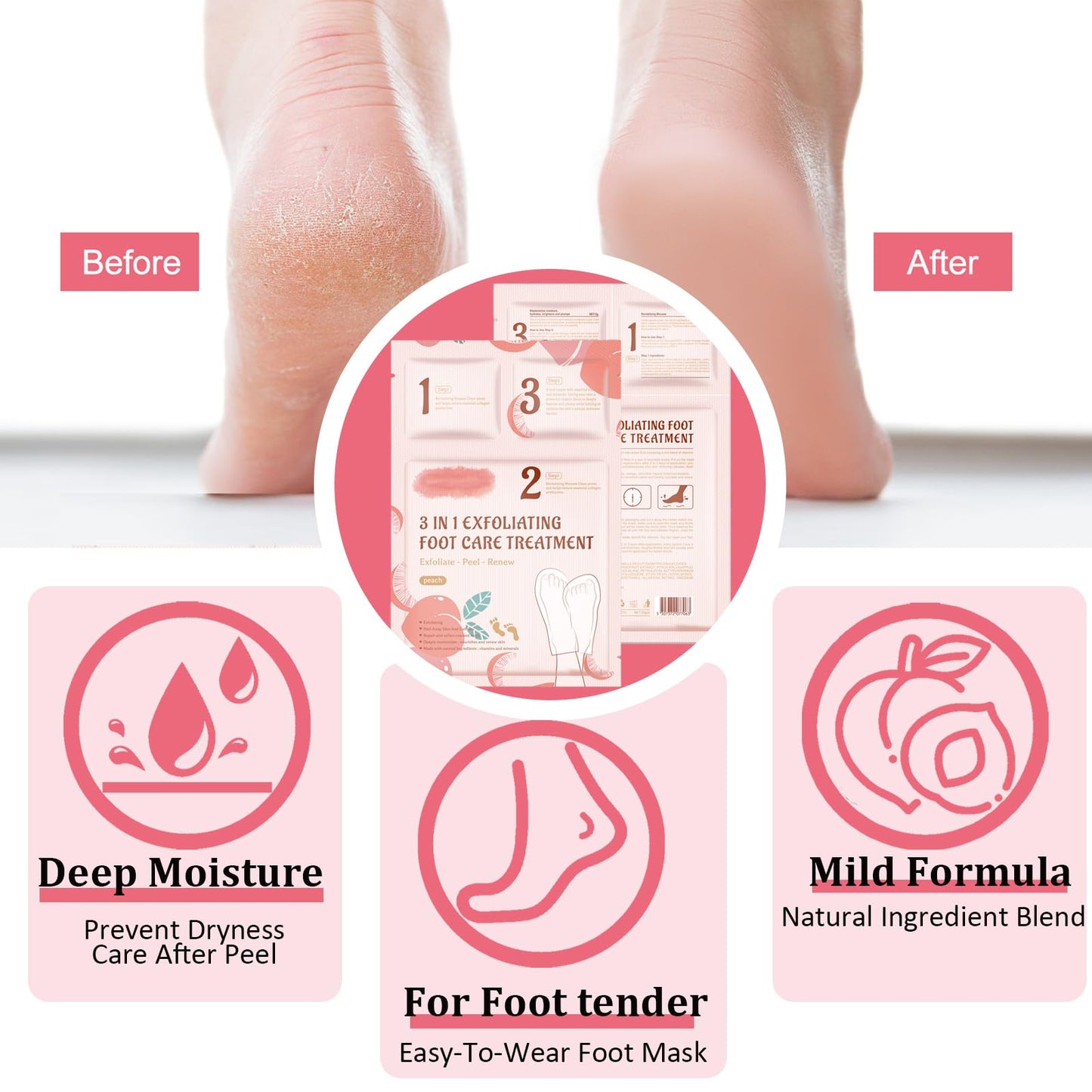 Shengqialun Foot Peel Mask With Peach Extract - Foot Mask For Hard Skin & Calluses - 3-In-1 Foot Care For Exfoliation, Moisturizing & Renewal - Natural Formula For Soft & Smooth Feet