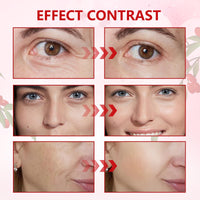 Ninnyi 2PCS Goji Berry Facial Cream for Ladies, Moisturizers Berry Facial Cream for Women