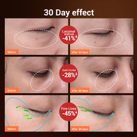 TOUCHBeauty Heated Eye Massager 40℃, Sonic Eye Massager with High Frequency Vibration Anti-Aging Galvanic Wand USB Rechargeable for Relieving Dark Circles and Puffines Anti Wrinkless AG-1662