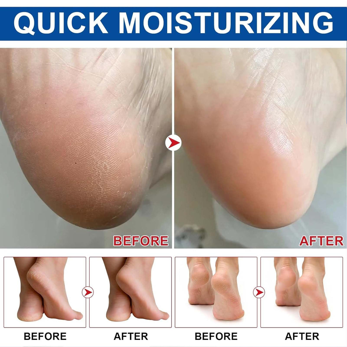 KTouler 2Pcs Urea Cream for Feet,Hydrating and Nourishing Foot Cream,Foot Repair for Dry Skin and Rough Heels,Hands,Knees Skin Care Heel Treatment,Foot Moisturiser for Dry Cracked Feet