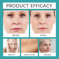 TINCAI Crepe Be Gone Body Souffle - 85g Firming Neck Cream,Ultra Hydrating Crepe Skin Firming Cream for Chest,Arms & Legs,Crepe Eraser for Women,Skincare Body Cream for Deep Hydration