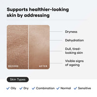 Cureskin Ceramide Moisturizer SPF 40 PA+++ Skin Barrier Repair Face Moisturizer for Men and Women | Hyaluronic Acid Moisturizer for Face | Anti Aging Cream for Women and Men