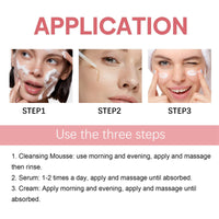 HIVETZ Aobenz Spot Remover for Face,Anti Spot Serum,Dark Spot Correcting Serum,Sun Spot Dark Spot Remover,Age Spot Treatment Face Serum,Skin Whitening Spot and Freckle Remover,Spot Treatment for Face,50ml
