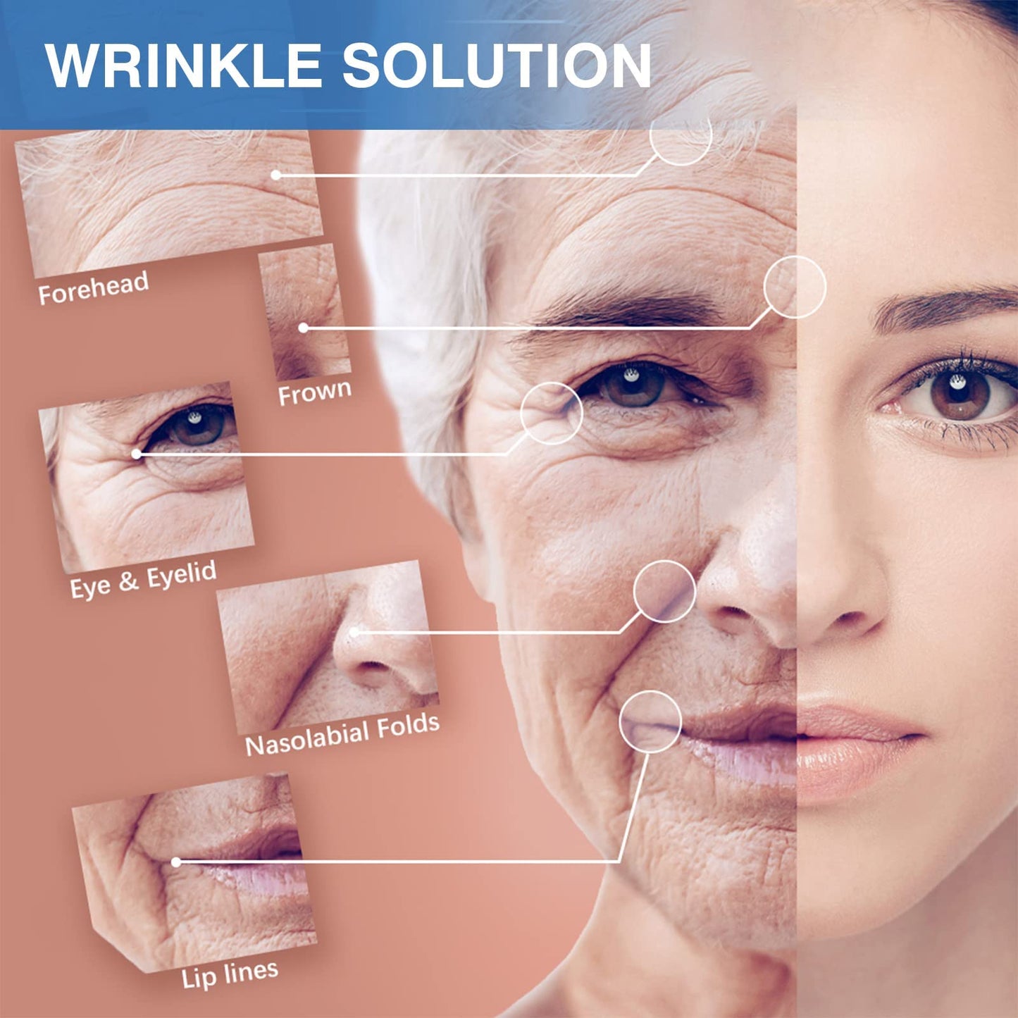 Sfuchin Facial Patches - Wrinkle Patch - Wrinkle Tape - Face Lifting Tape - Non-invasive wrinkle remover - Multifunctional High Elasticity Wrinkle Forehead Eyes Face Neck Lips Wrinkle Treatment - 2.5CM*1000CM