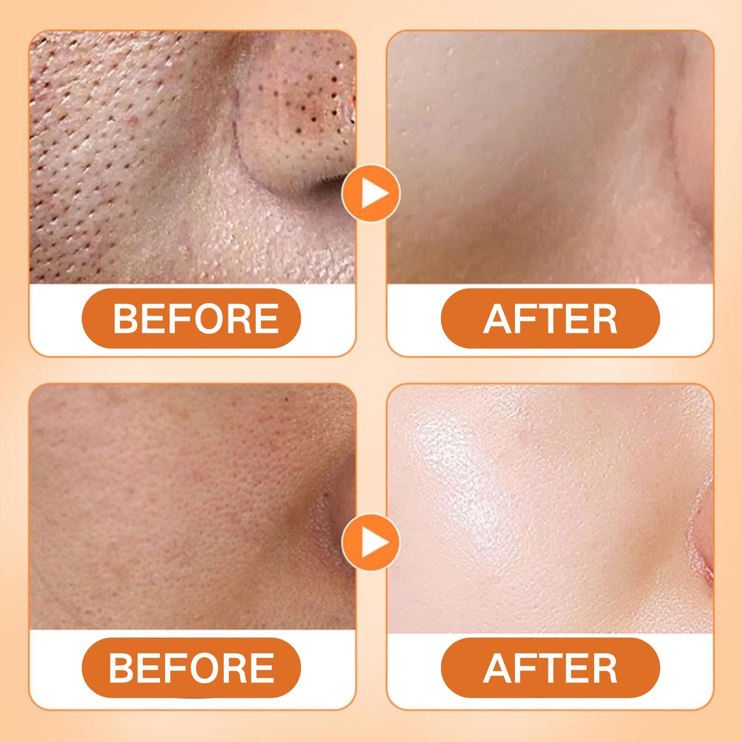 IZBEAUVO Kojic Acid & Turmeric Face Wash,Kojic Acid Foaming Cleanser,Deep Cleansing Brightening Face Wash,Foaming Facial Cleanser for Exfoliating, Unclog Pores, Acne Scars, Smooth Skin for All Skin Care