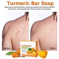 2PCS Wormeer Turmeric Soap Bar, Tumeric Soap for Face & Body,Turmeric Cleansing Bar, Rich in Narious Nutrients, It Is Equipped with a Foam Net to Improve Fine Lines