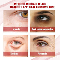 Haiyox Mi-lia Removal,Mi-lia Treatment,Mi-lia Treatment Under Eye,Mi-lia Removal Spot Care,Mil-ia Remover Serum For Face,Dark Circle Corrector,Anti Aging Anti Wrinkle,Reduces Bags,Saggy Skin & Puffy Eyes