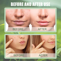 Oumun Relief Mud Mask,Recovery Mud Mask,Body Mud Cleanser Face & Body Ma-sk,Peel Ma-sk,Fa-ce Ma-sk,Glass Skin Hydrating Ma-sk,Fa-ce Masks Skincare,Clay Mask,Pe-el off Fa-ce Masks,Mud Ma-sk for Fa-ce