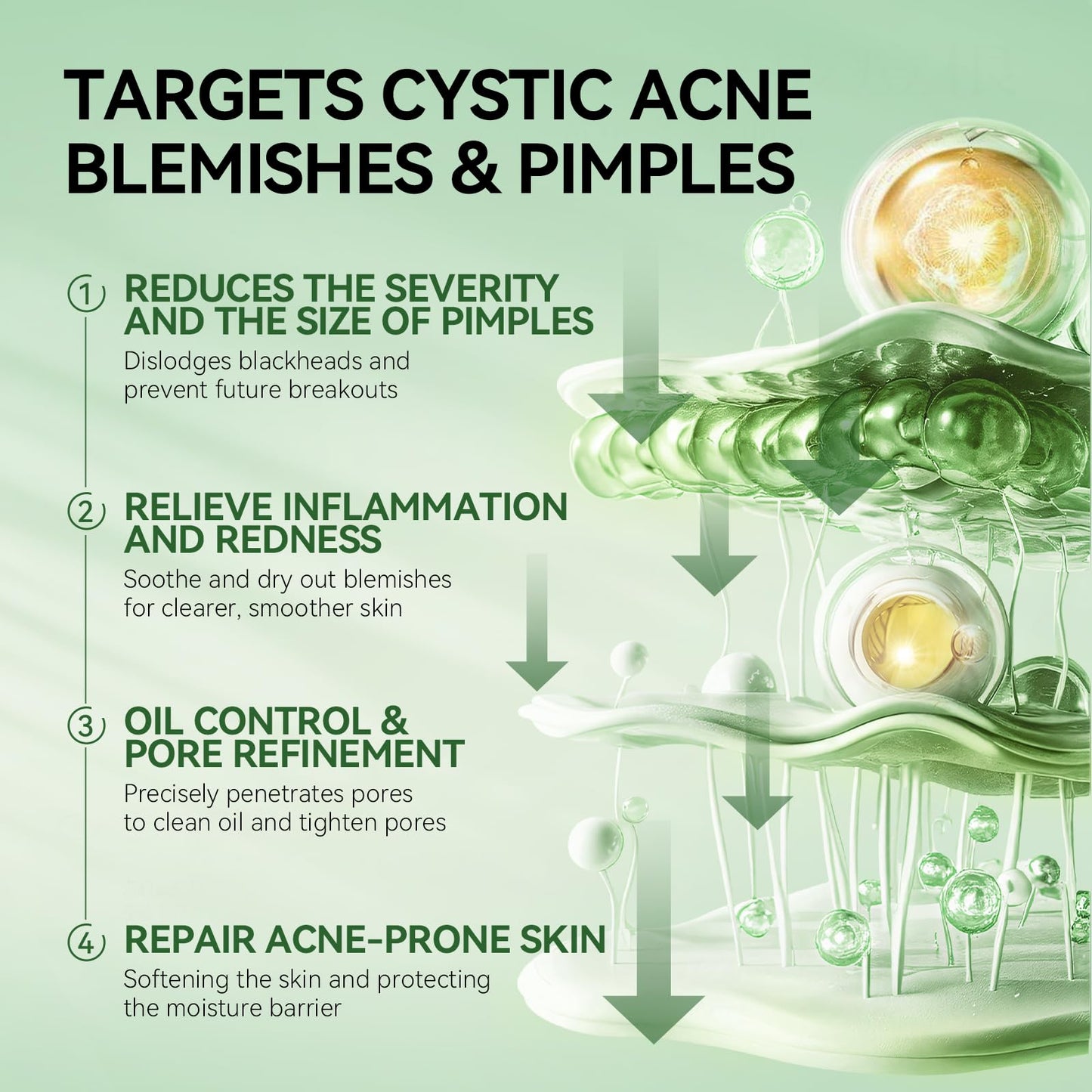 LANBENA Precision Acne Spot Serum, Acne Drying Lotion, Overnight Acne Treatment For Face, Dry Out Pimples, Blemishes, Zits And Clean Pores, 0.42 Fl Oz (Pack of 1)