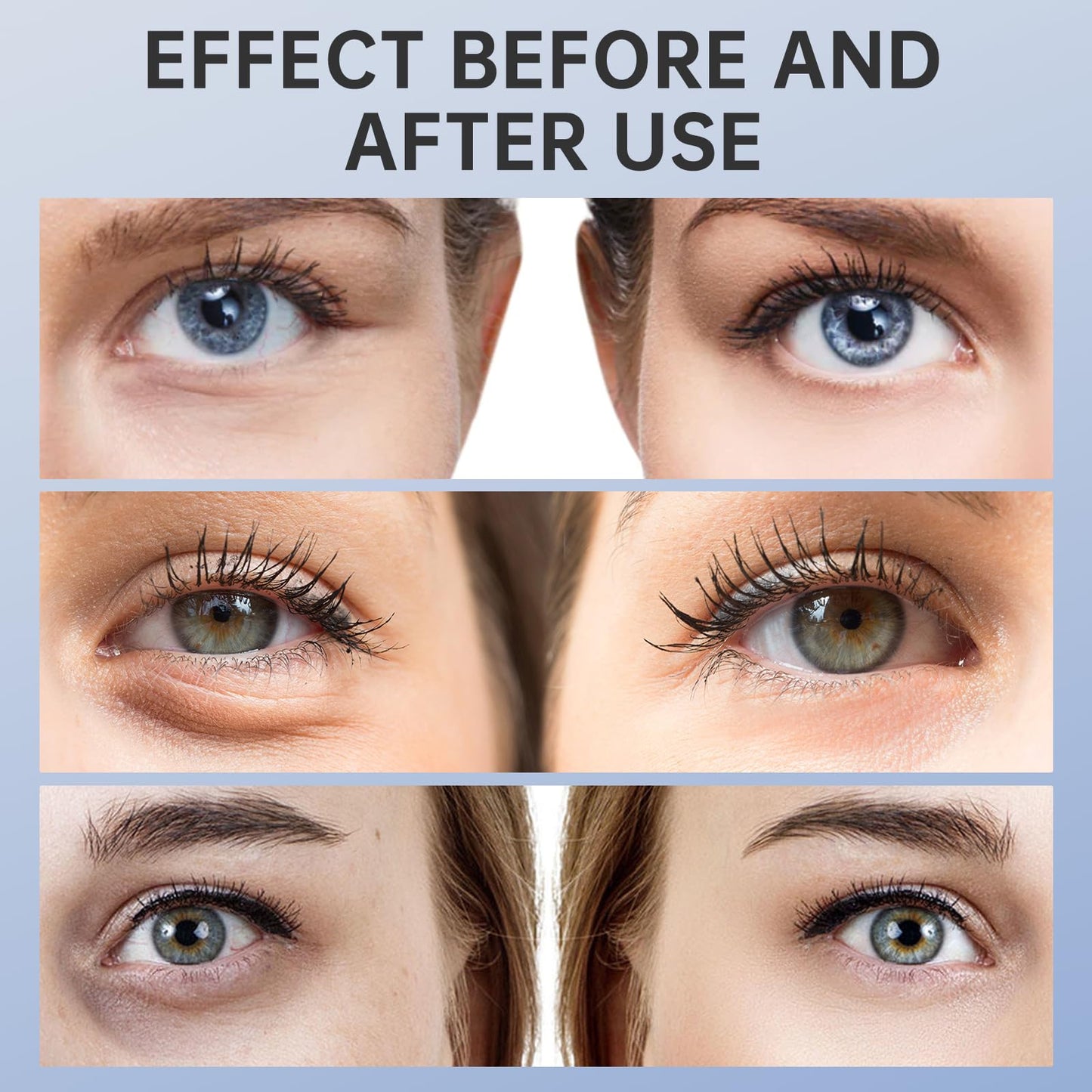 Ninnyi Eye Cream for Dark Circles and Puffy Eyes, Reduces Under Eye Bag and Wrinkles, Tighten Saggy Skin