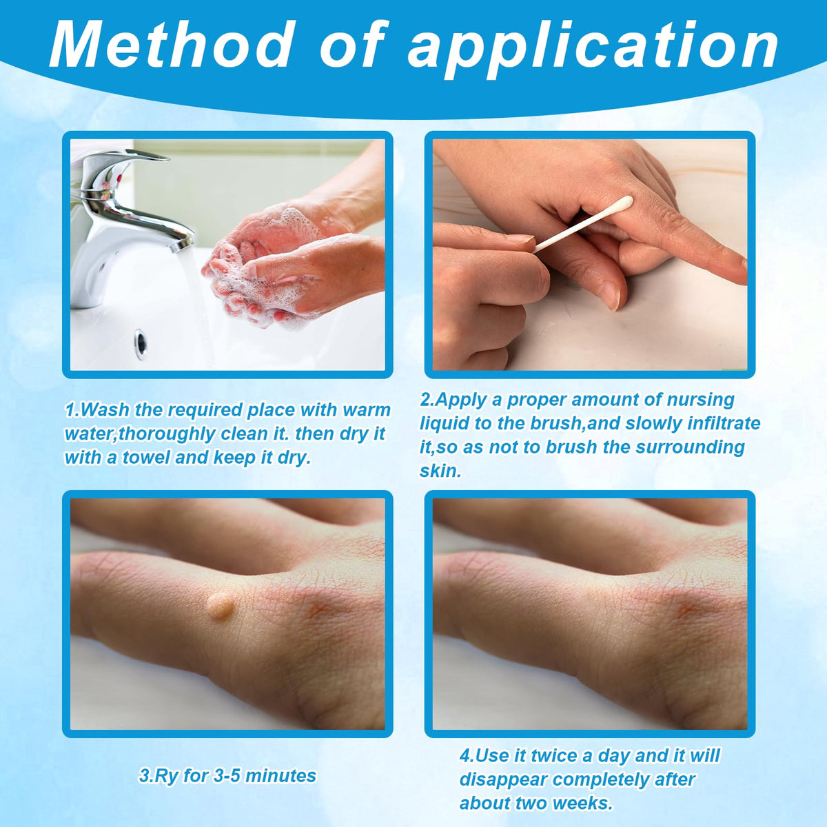 Enigmapn Wart-Remover Painless Skin and Fast-Acting, Wart-Remover for Hands and Body Fall Away Quickly, Natural Remover-15ml