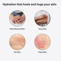 Dermz Healpsorin Antifungal Body Wash: Psoriasis, Eczema, Dermatitis and Sensitive Shower Gel - Eczema Treatment - 500ml