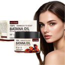 EveBeaty 120ml Pure Batana Oil for Hair Growth – Nourishes Scalp, Damage, Promotes Healthier, Thicker, Fuller Hair