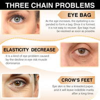 XAYGHE Caffeine Eye Stick, Caffeine Eye Cream for Dark Circle and Puffiness, 3-4 Weeks Improve Eye Bags and Fine Lines, Eye Anti Aging Treatment Smooth Skin…