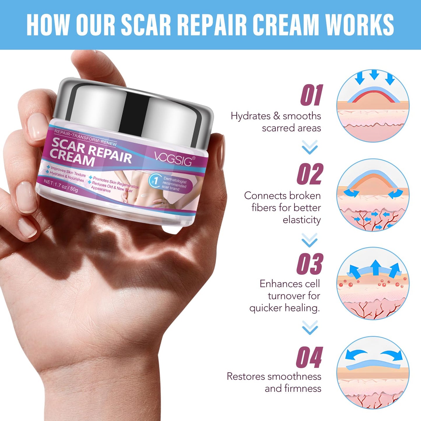 mysemgshuo 50g Advanced Scar Gel Cream, Scar Repair Cream, Scar Removal,Scar Treatment, Scar Removal Cream for C-Section, Stretch Marks, Acne, Effective for Both Old and New Scars