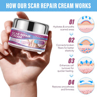 mysemgshuo 50g Advanced Scar Gel Cream, Scar Repair Cream, Scar Removal,Scar Treatment, Scar Removal Cream for C-Section, Stretch Marks, Acne, Effective for Both Old and New Scars