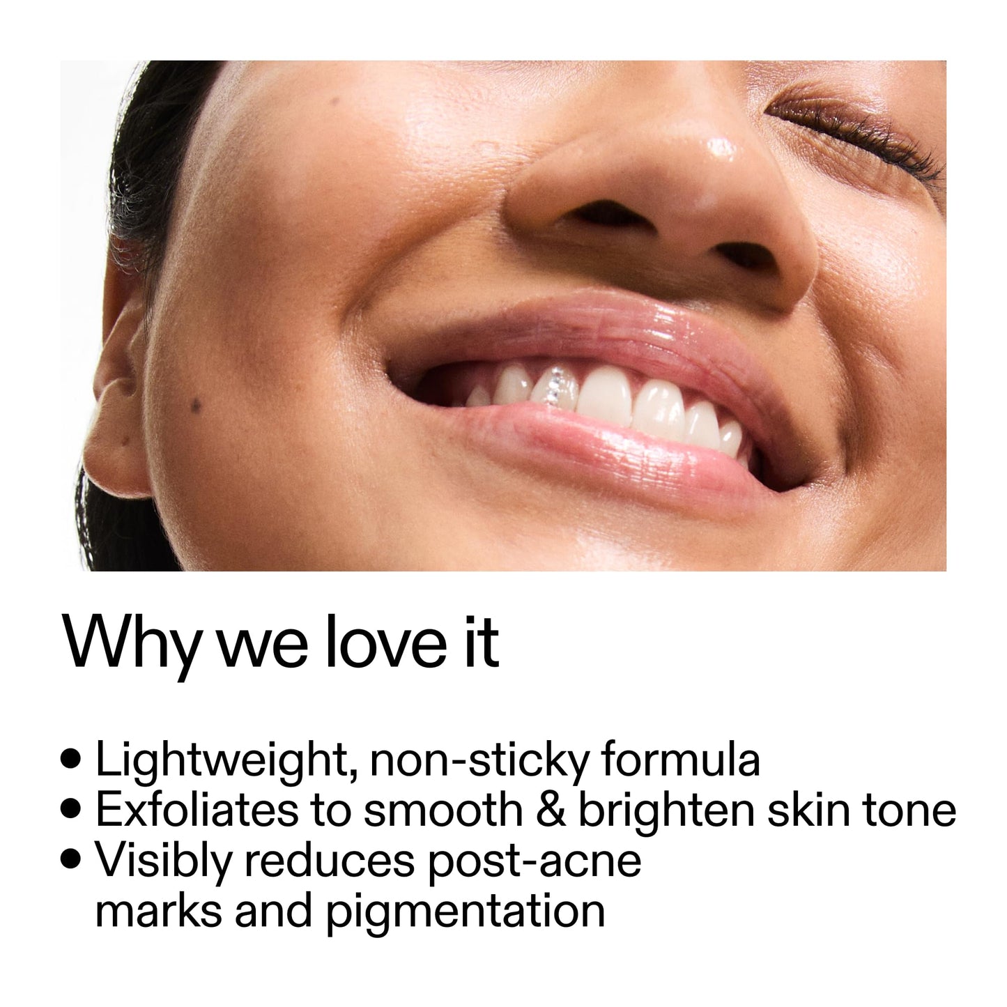 The INKEY List Mandelic Acid Treatment 15ml