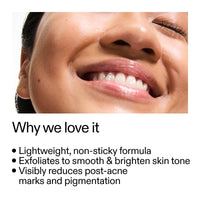 The INKEY List Mandelic Acid Treatment 15ml