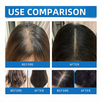 Sca-lp Cooling Hair Ampoule, Hair Growth Serums for Hair Loss,Sca-lpy Ha-ir Gro-wth Serum for Men & Women,Ha-ir Loss Treatment for Women,Ha-ir Oil for Dry Damaged Ha-ir,Dry Ha-ir Treatments