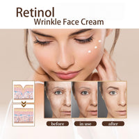Revive Eye Cream for Face And Neck,Retinol Anti Aging Eye Cream,Ey/e Cre/am for Dark Circles And Puffy Eyes,Ey/e Bags Remover,Peptides Anti Wrinkle Ey/e Cream,Retinol/Dark Circle E/ye Crea/m,