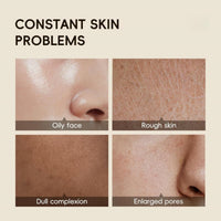 Heefeng 2PCS Turmeric And Ko-jic Acid Soap,Turmeric Soap Bar,Brightening Soaps,Deep Cleansing & Smooth Skin,Even Skin Tone,Refreshing,Moisturize And Nourish Firming Pores And Removing Yellow,For Face & Body