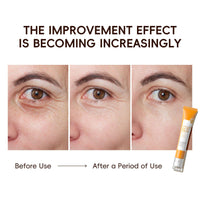 Vitamin C Eye Serum,Eye Bags Remover Women,Eye Roller for Dark Circles and Puffiness,Skincare for Dark Circles Under Eye Treatment Women,Liquid Eye Cream with Niacinamide,Caffeine