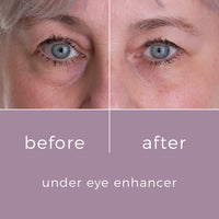 Skin Bunny Under Eye Enhancer – Eye Cream for Dark Circles and Puffy Eyes – Anti Aging Anti Wrinkles Caffeine Eye Cream for Eye Bags Remover Men and Women – Eye Serum 200 Applications