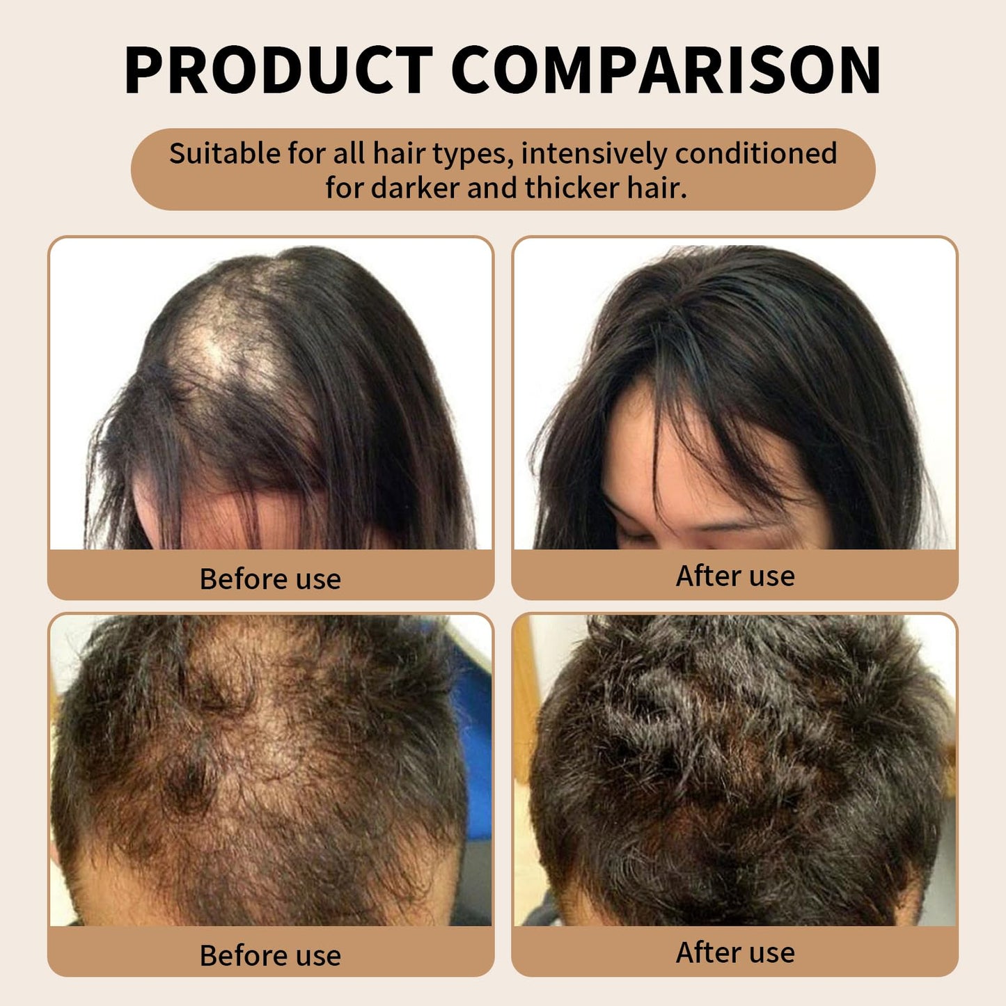 COWANIEE Spartan Root Activator Shampoo 100ml+ Conditioner for Men & Women 100g