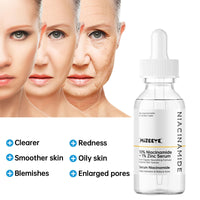 MIZEEYE Niacinamide Serum for Face, 2PCS Moisture Niacinamide Face Serum for Women, Niacinamide 10% + Zinc 1% Serum For Acne, Refreshing.