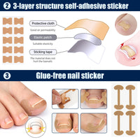 BQMEZRNUS Ingrown Toenail Removal Kit Ingrown Toenail Treatment Tool Kit Ingrown Toenail Corrector Tools with Toenail Braces, Podiatry Tools, Ingrown Toenail Corrector Strips and Patch for Toe Pain Relief