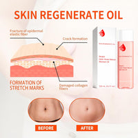EliiSkinn Stretch-Marks, Scar Treatment Oil - Helps Reduce The Appearance Of Stretch Marks & Scars -Non-greasy Moisturizer Lotion- Improves Appearance of Stretch Marks, Scars, and Uneven Skin Tone - 125ml