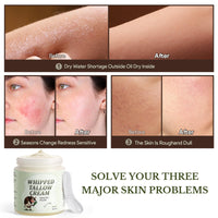 Beef Tallow Skin Care, Whipped Tallow Face Cream, Beef Tallow Moisturiser for Face & Body, Natural Grass Fed Beef Tallow, Skin Care Cream for Dry Skin, Vanillin, 120g