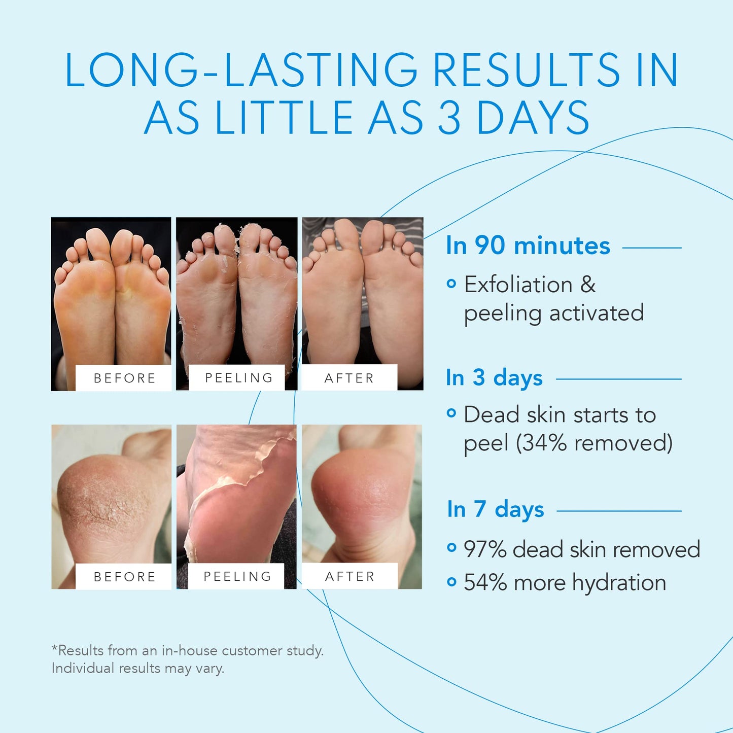 Ondée Thermale Foot Peel Mask - Exfoliating Foot Masks, Moisturising Foot Mask with Vitamin E, Foot Peel Mask for Hard Skin, Callus and Cracked Heels - Foot Care Foot Mask Peel, 1 Foot Pack