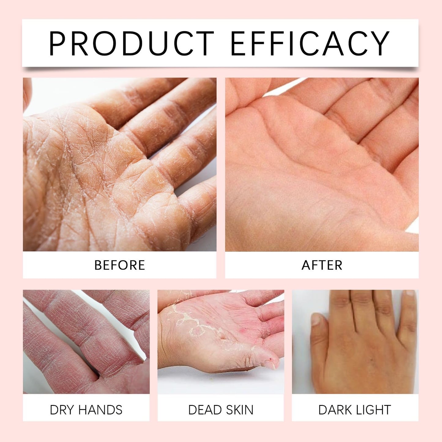 AHVKNU Retinol Hand Cream,Retinol Anti-Aging Hand Lotion,Retinol Moisturizer with Shea Butter & Collagen for Smooth, Youthful Looking Hands, Nails & Cuticles.Relief Intense Moisture Hand Cream for Women Men