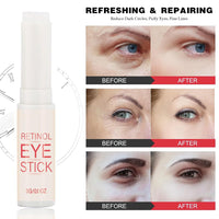 LUMKMAS Retinol Eye Stick, Retinol Serum Eye Cream Stick for Dark Circles, Puffy Eyes, Reducing Fine Lines, Anti-Aging Eye Brightener, Moisturizing & Refreshing Under Eye Cream for Women