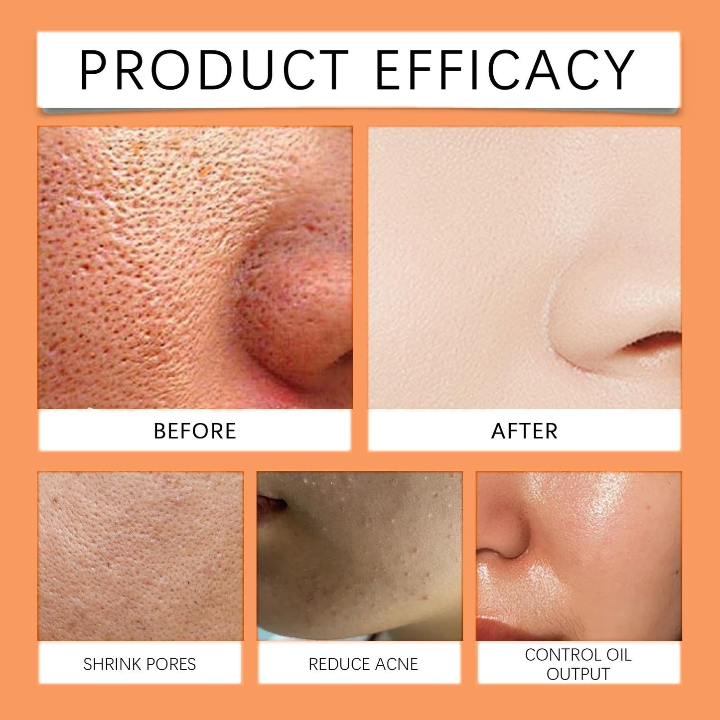 Orange Peeling Gel,Orange Enzymes Exfoliating Gel,Facial Scrub Exfoliating Cleanser,Deep E/xfoliating Cleanser,Face and Body Exfo/liating Scrub G/el,Whitening Deep Exfoliator,Facial Exfoliator