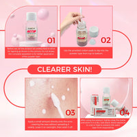 OUKEYA Spot Drying Lotion for Spots 2 x 10ml, Acne Care for Face with Salicylic Acid & Niacinamide, Oil Balancing, Pore Refining, for Acne-Prone and Oily Skin
